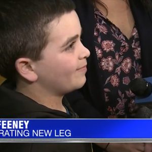 ryan feeney ‘There’s no limits’: 9-year-old athlete fitted with new prosthetic leg